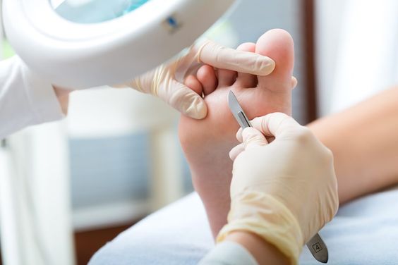ColdPlasma võib surmata koronaviiruse (COVID-19 )erinevatel pindadel sekunditega.