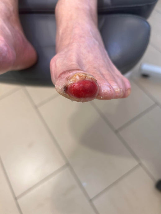 Eakate jalgade tervis ja nende hooldamine