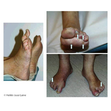 Load image into Gallery viewer, Raamat - e-raamat &quot;Diabeetilised jalad ja nende hooldus &quot;
