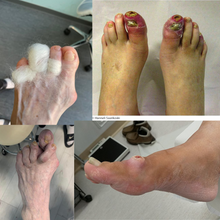 Load image into Gallery viewer, Raamat - e-raamat &quot;Diabeetilised jalad ja nende hooldus &quot;
