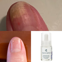 Load image into Gallery viewer, Nail fungus remedy  SAICARA NAGELÖL is nail oil  for nail fungus prevention and home follow-up treatment and care of brittle and sensitive nails. 15 ml
